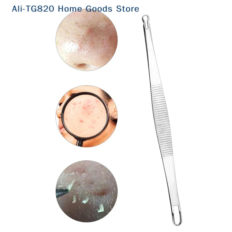 Double-Ended Stainless Steel Acne & Blackhead Extractor