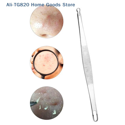Double-Ended Stainless Steel Acne & Blackhead Extractor